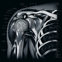 МРТ плечового суглобу