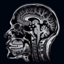 МРТ скронево-нижньощелепного суглоба